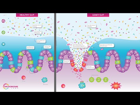 Total Gut Restoration – Kit 2